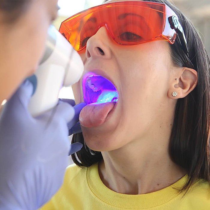 woman with protective glasses on getting oral cancer screening