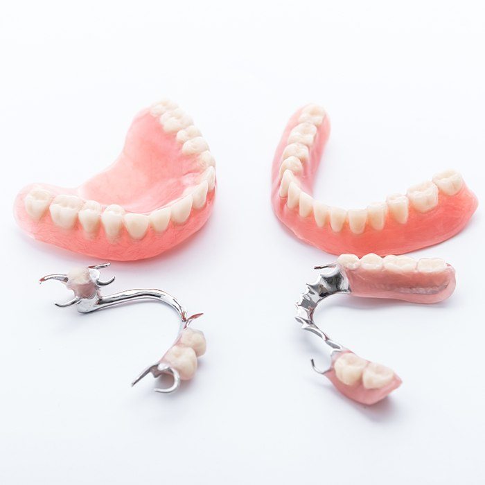 four examples of dentures