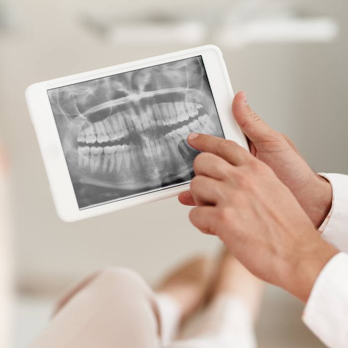 dentist pointing to x-ray on tablet