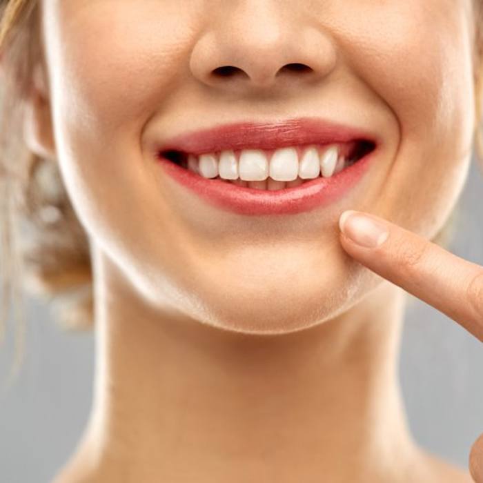 close up of woman pointing to smile after getting cosmetic bonding in Charlottesville 