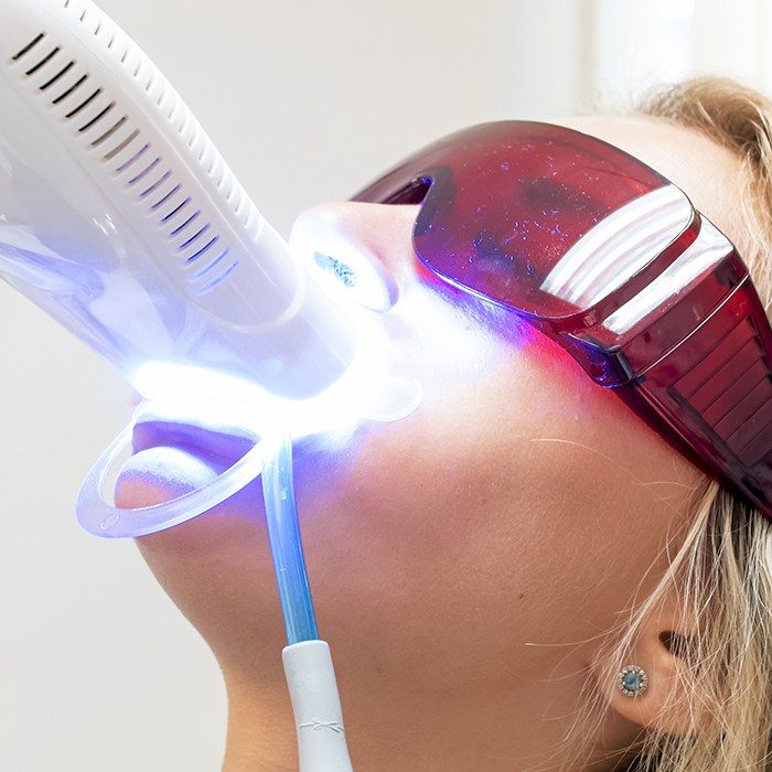 woman having teeth whitening done