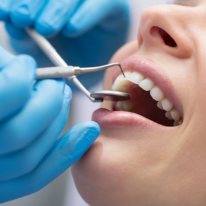 woman having gum recontouring done