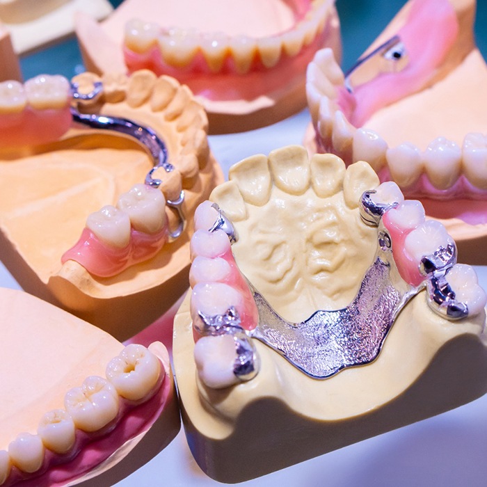 partial dentures placed on models of mouths
