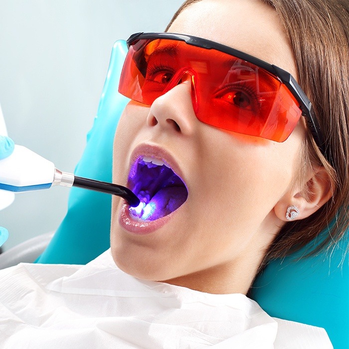 girl with protective glasses on getting dental sealants