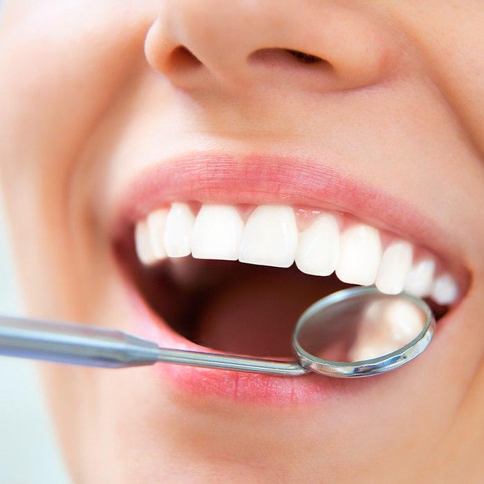 close shot of perfect white smile of restorative dentistry in Charlottesville
