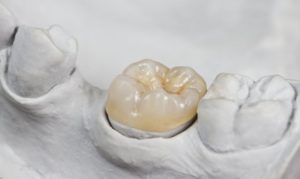 dental crown inside mold