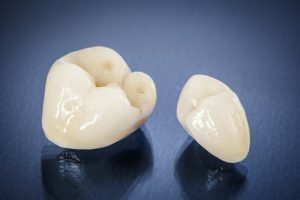 dental crowns in charlottesville